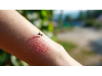 如何在草原旅行中防止蜱虫叮咬
